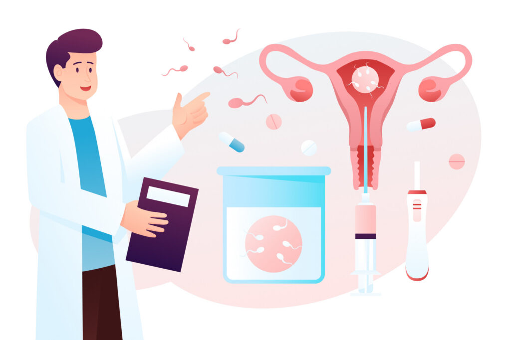 Illustration einer Insemination mit Arzt und Darstellung der Gebärmutter.